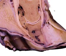 Hufrehe bei einem Pferdehuf